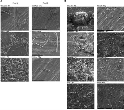 Nanostructures Formed by Custom-Made Peptides Based on Amyloid Peptide Sequences and Their Inhibition by 2-Hydroxynaphthoquinone